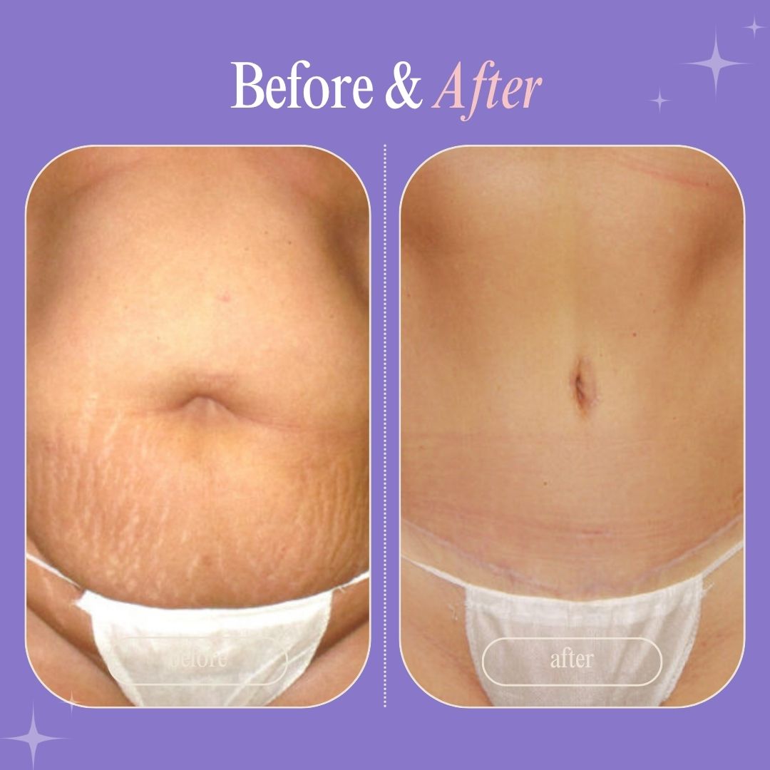 Clinically Crafted to Tighten, Smooth & Restore — by Skin Recovery Labs