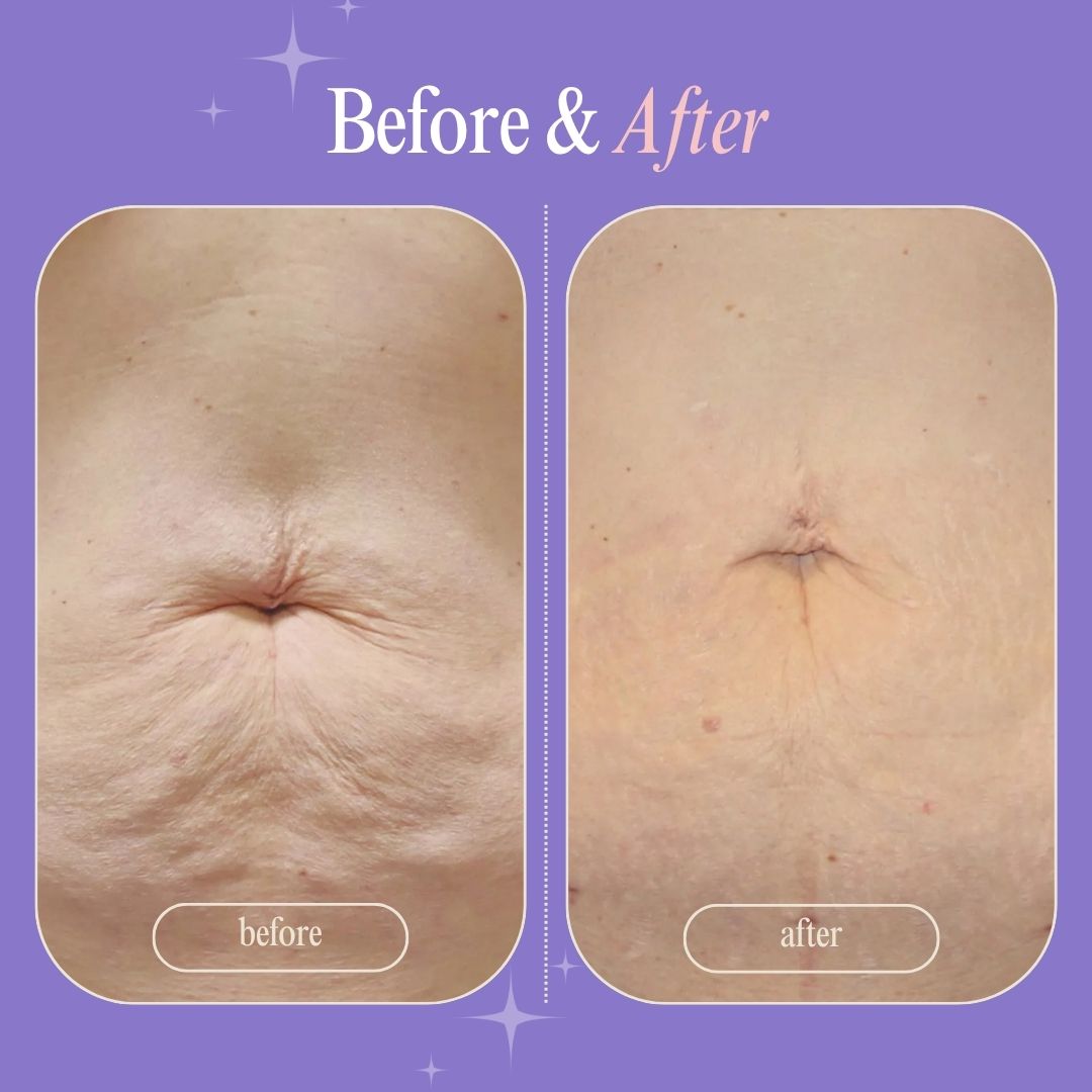 Clinically Crafted to Tighten, Smooth & Restore — by Skin Recovery Labs