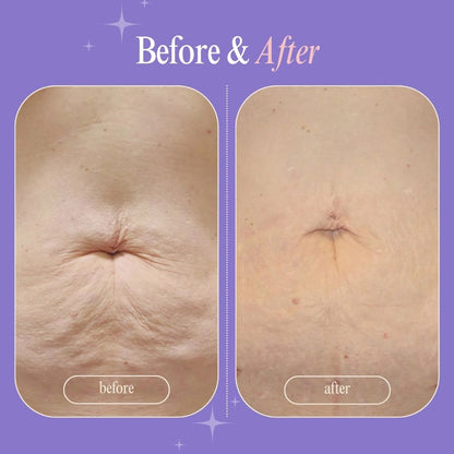 Clinically Crafted to Tighten, Smooth & Restore — by Skin Recovery Labs