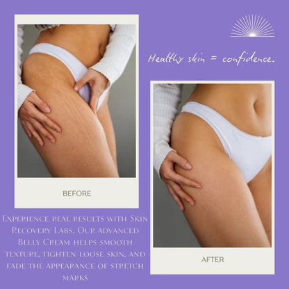 Clinically Crafted to Tighten, Smooth & Restore — by Skin Recovery Labs